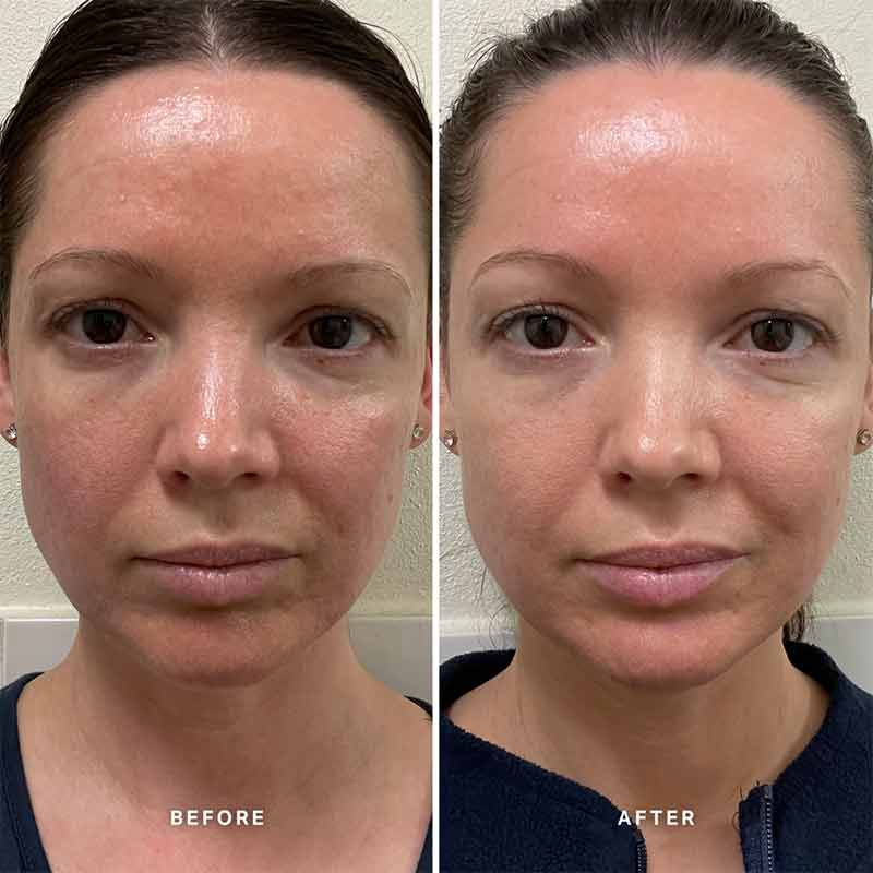 Alpha H Vitamin B Serum with 5% Niacinamide - Brightening & Hydrating Face Serum for Glowing Skin - Perfect for Daily Skincare Routine & Anti-Aging Care