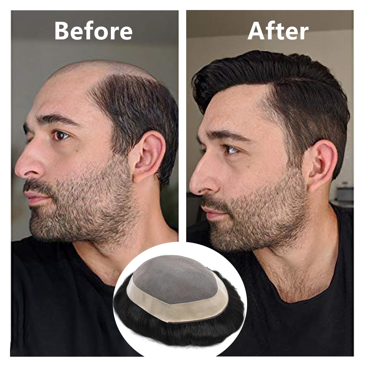 Premium Men's Toupee - European Human Hair Replacement System - Durable Fine Monofilament with Poly Coating - 3# Dark Brown - Medium Density 6x9 - Natural Looking Hairpiece for Daily Wear & Special Occasions
