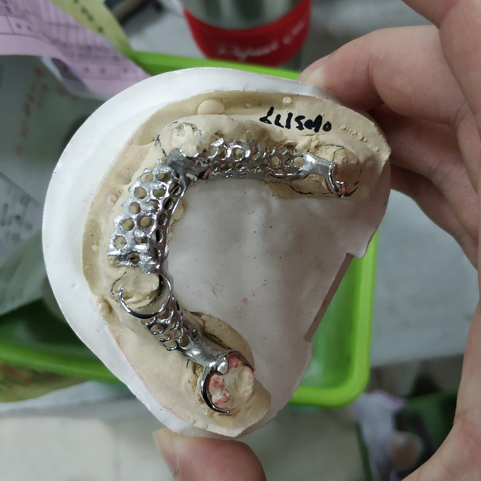 RESIONE C01 High Precision Clear Castable Dental Resin for 3D Printing - Perfect for Crowns, Bridges & Dental Brackets - Ideal for Dental Labs & Orthodontic Applications