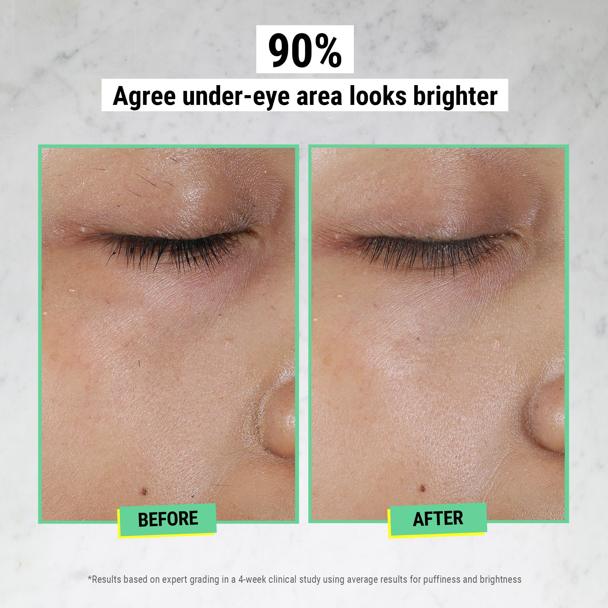 Best Creamy Avocado Eye Treatment for Dark Circles & Wrinkles - Hydrating & Anti-Aging Eye Cream for Day & Night Use - Perfect for Dry Skin & Sensitive Eyes