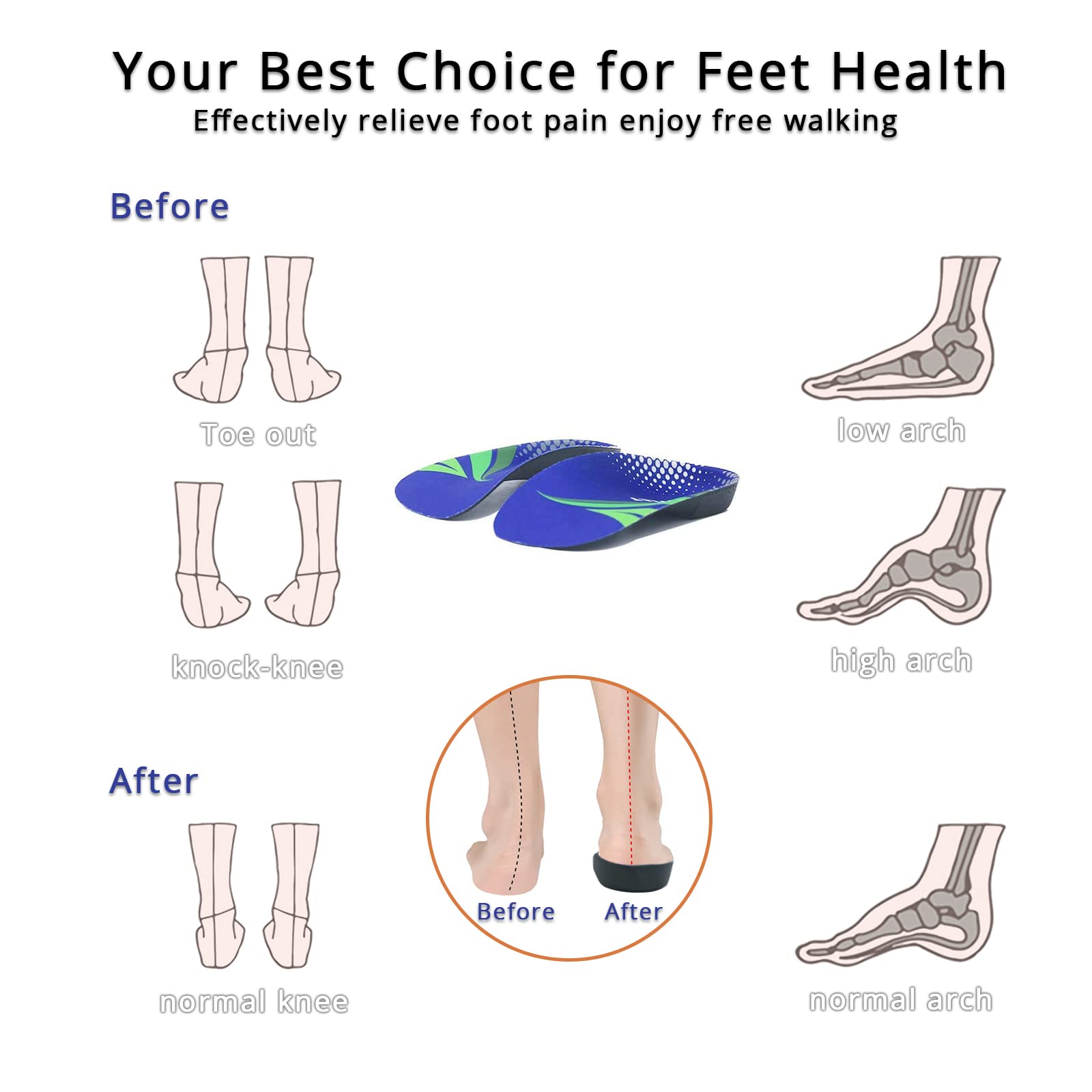 Best Orthotic Insoles for Over Pronation - 3/4 Length High Arch Support Inserts for Plantar Fasciitis, Flat Feet & Heel Pain Relief - Comfortable Shoe Insoles for Men & Women Running, Walking & Sports - Perfect for Daily Use & Athletic Activities