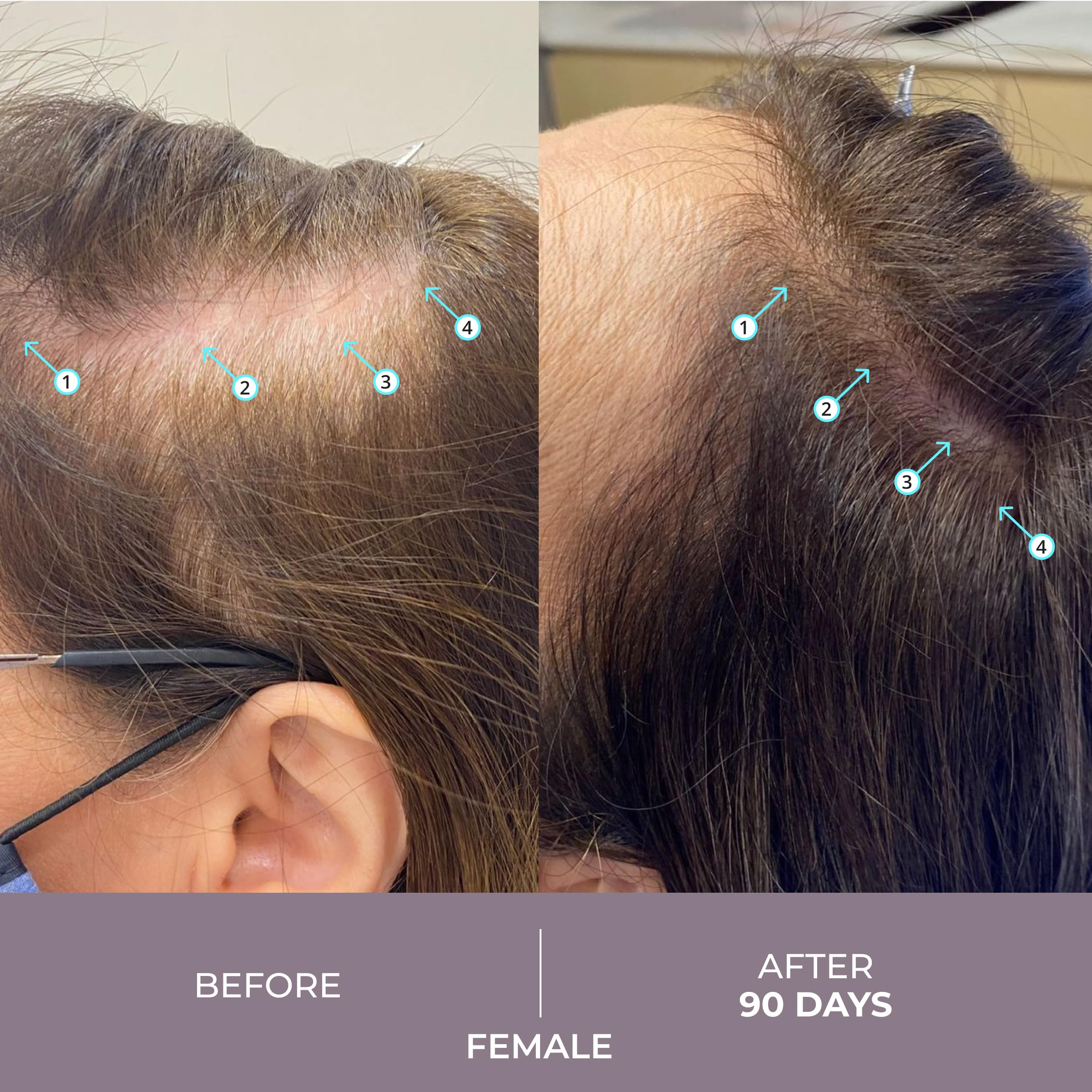 DS Laboratories Spectral.CSF Biotin Hair Serum for Women - Hair Regrowth & Thickening Treatment for Thinning Hair | Strengthens & Nourishes for Fuller, Healthier Locks | Perfect for Daily Use & Styling Prep