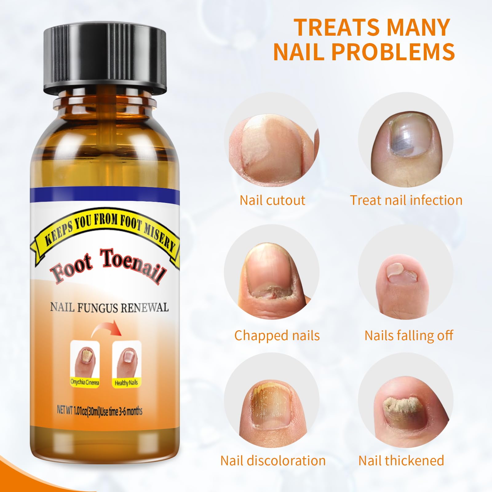 Extra Strength Toenail Fungus Treatment Fluid with Soft Brush Head - 30ML for Fast & Effective Nail Fungus Removal | Home Foot Care Solution for Athletes, Swimmers & Daily Use