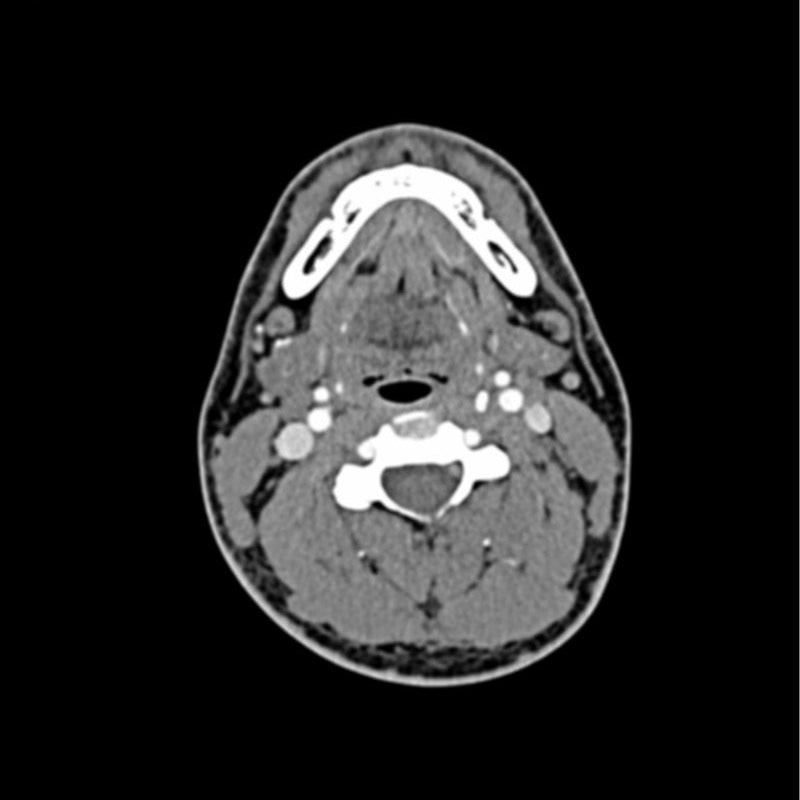 Head and Neck CTA Phantom AVM for CT Scan & X-Ray Training - Medical Imaging Practice, Radiology Education, and Diagnostic Testing