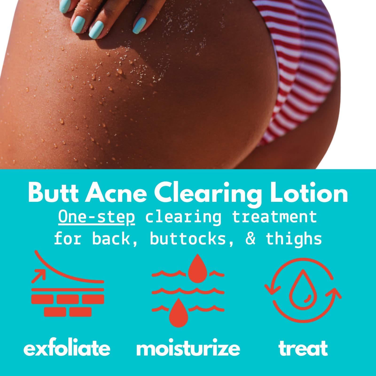Best Butt Acne Clearing Lotion for Body Breakouts - Fast-Acting Acne Treatment for Back & Bum Pimples - Perfect for Gym-Goers & Active Lifestyles