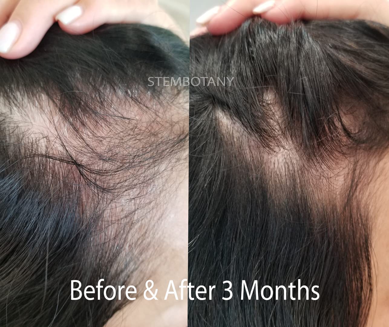 GHK-Cu Copper Peptide Hair Growth Shampoo for Men & Women - Stimulates Hair Regrowth, Thickens & Strengthens Hair - Ideal for Thinning Hair & Scalp Care (For Daily Use at Home & Salon)