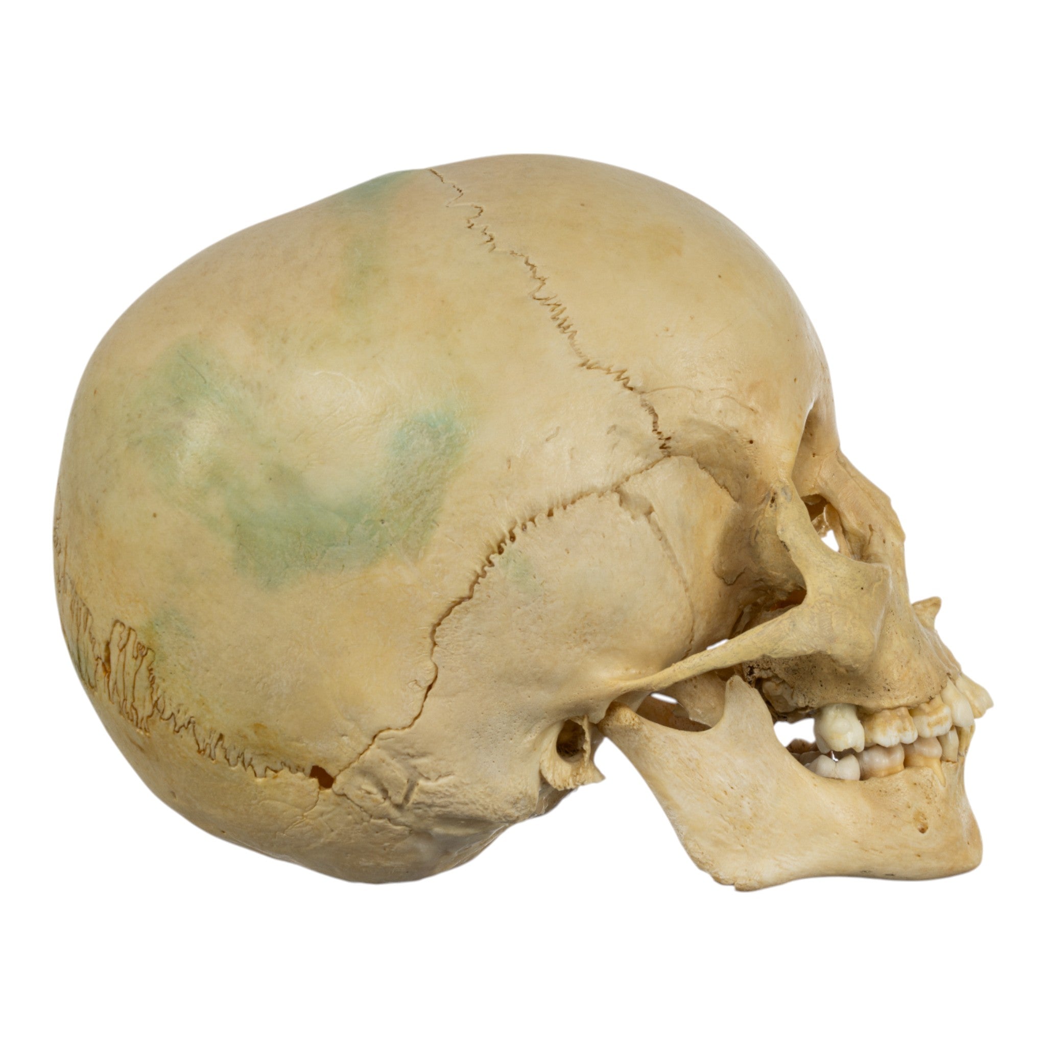 Real Human Child Skull Model - Anatomical Replica for Medical Study, Halloween Decor & Educational Display | Perfect for Classrooms, Haunted Houses & Science Labs