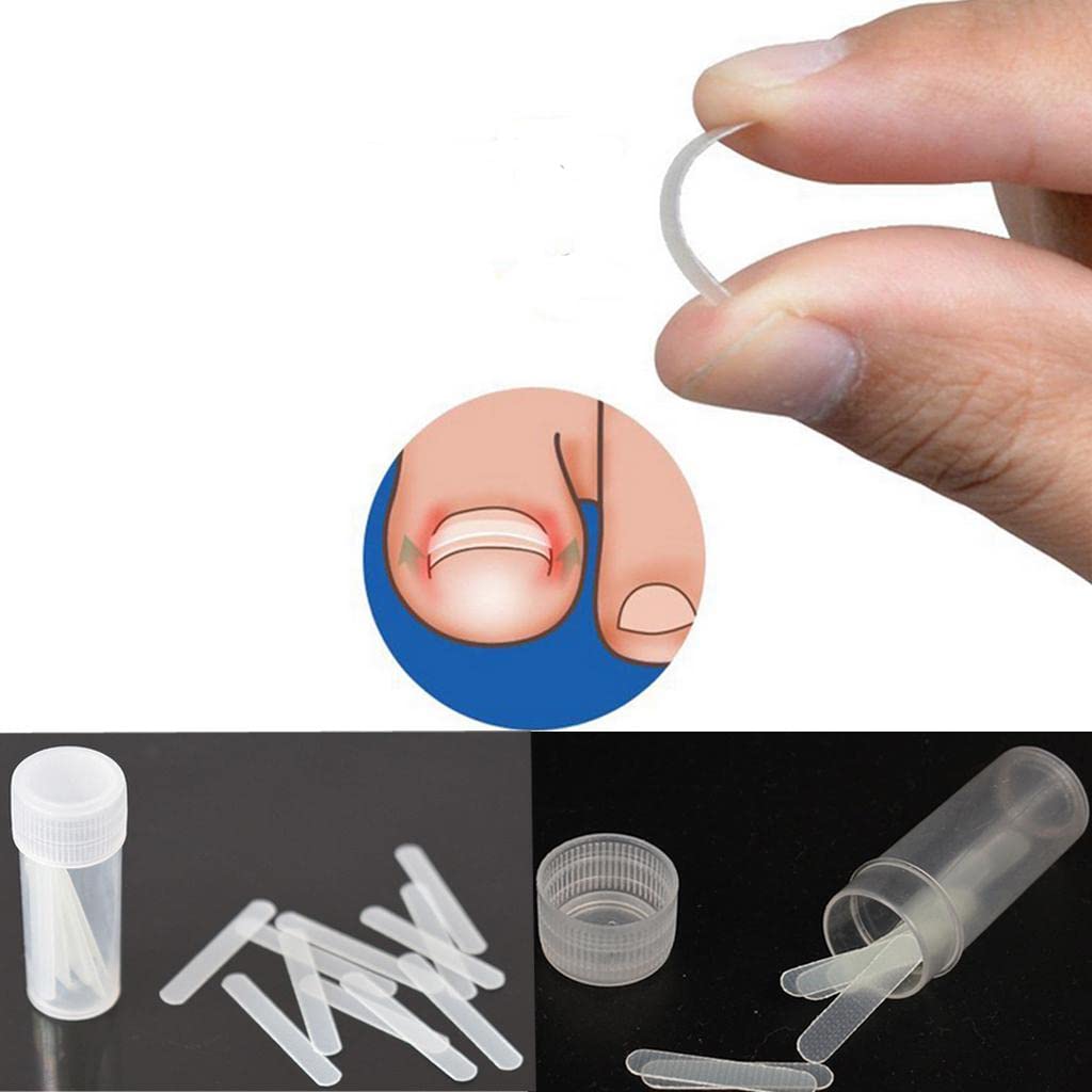 MYADDICTION Ingrown Toenail Correction Patch Kit - Professional Toenail Care Tool for Pain Relief & Paronychia Treatment | Perfect for Pedicure, Manicure & At-Home Nail Care | Ideal for Daily Use, Post-Surgery Recovery & Nail Salon Professionals