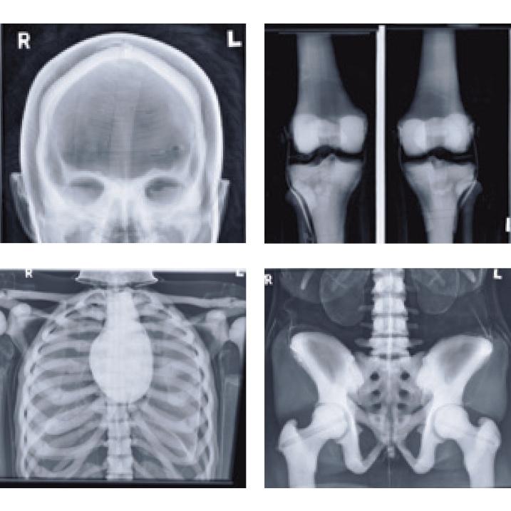 Full Body X-Ray and Radiographic Positioning Manikin - Professional Medical Training Model for Radiology Students & Technicians - Perfect for Classroom, Lab & Clinical Practice