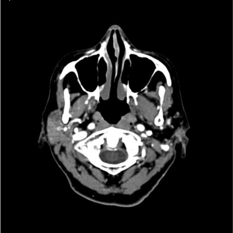 Professional CTA Head and Neck Phantom - High-Quality CT Scan & X-Ray Training Model for Medical Education | Perfect for Radiology Students, Technicians & Clinical Practice