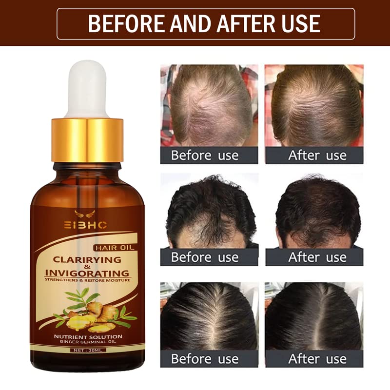 EIBHC Ginger Germinal Oil for Hair Growth - Natural Ginger Essential Oil Serum to Stop Hair Loss & Thinning - Hair Regrowth Treatment for Women & Men (30ml) - Promotes Healthy Scalp & Stronger Hair for Daily Hair Care Routine