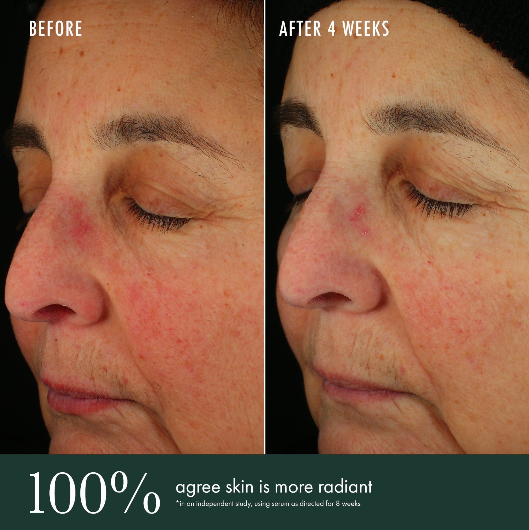 Best Brightening Serum for Glowing Skin - Vitamin C Face Serum for Dark Spots & Hyperpigmentation - Perfect for Daily Skincare Routine & Nighttime Use