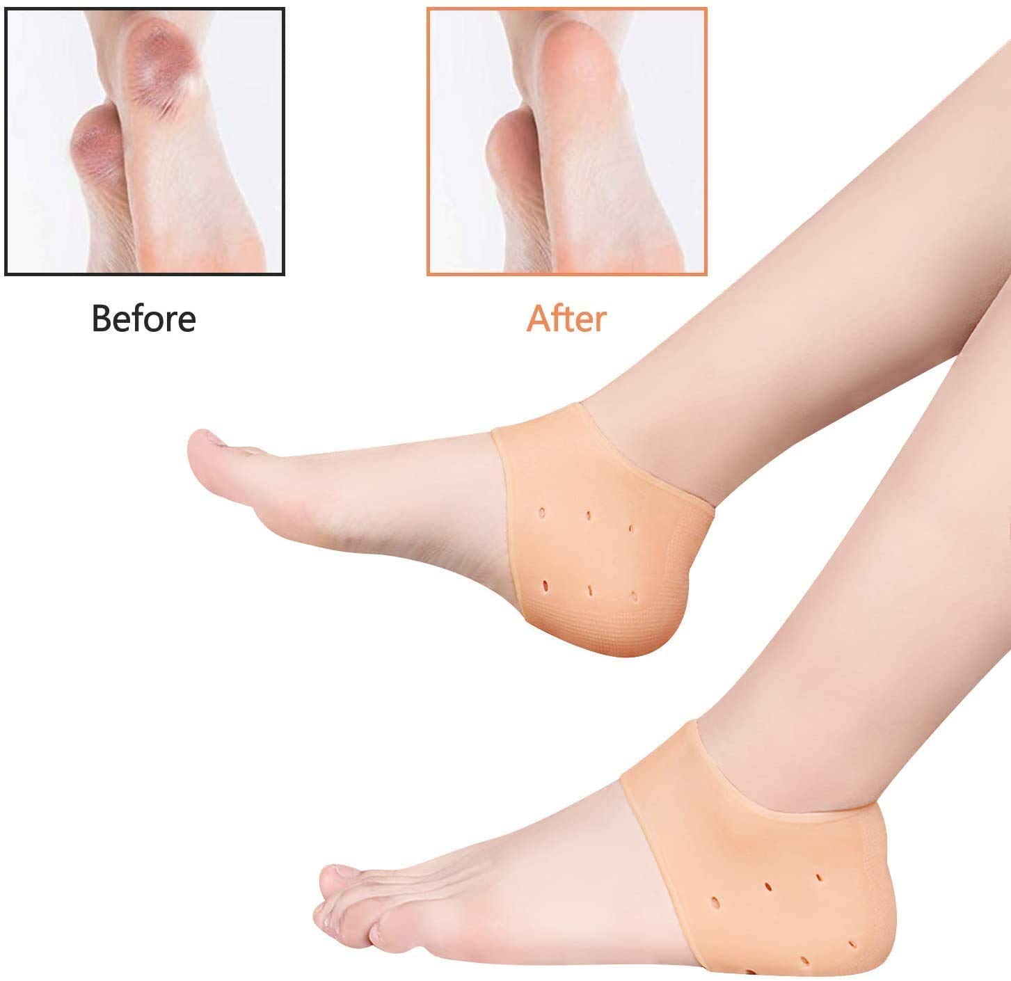 Anti Crack Silicone Gel Foot Protector - Ultra-Soft Pad Socks for Foot Pain Relief & Heel Crack Repair - Unisex Free Size (Pair of 1) - Perfect for Dry Cracked Feet Care at Home, Work or Gym
