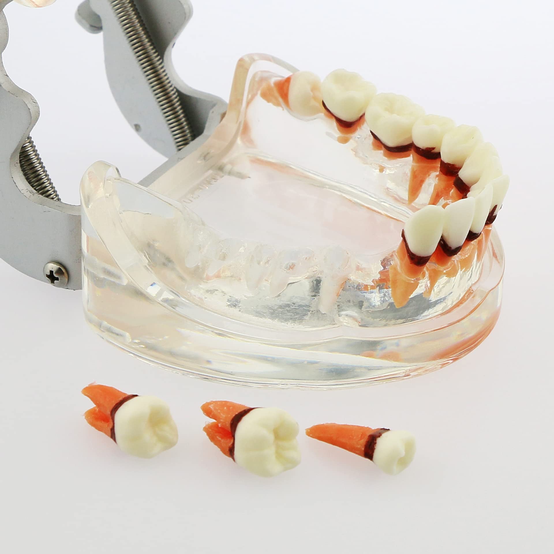 Adult Transparent Dental Teeth Model - Removable Gingivae for Pathology Study & Teaching - Perfect for Dental Students, Dentists & Medical Professionals