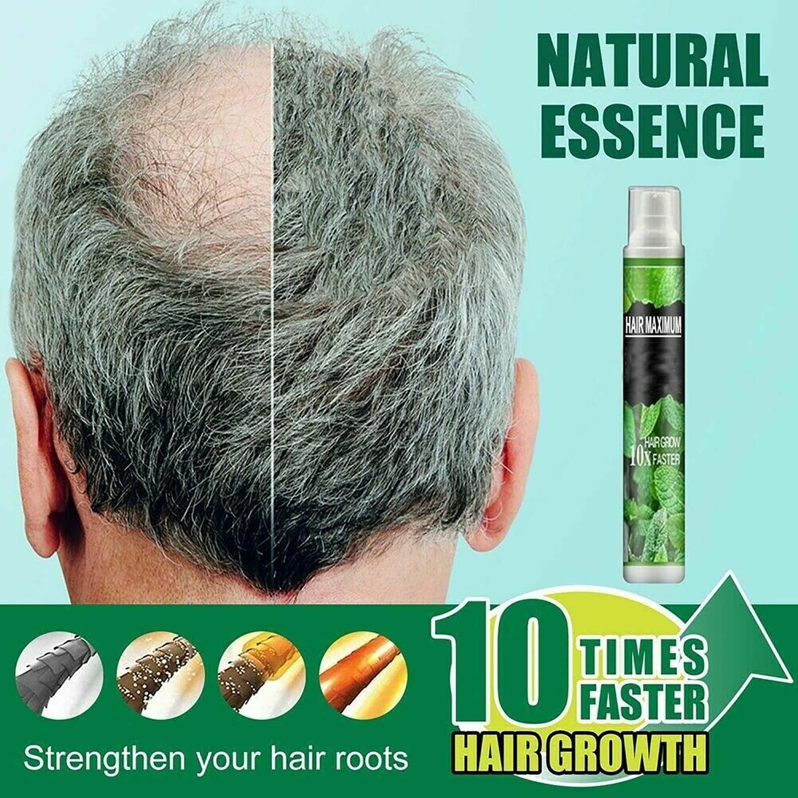 Natural Herbal Hair Growth Essence Spray - Prevent Postpartum Hair Loss & Stimulate Fast Growth | Anti-Hair Loss Serum for Dry Hair (3 Pack) | Perfect for Post-Pregnancy Care & Daily Hair Regimen