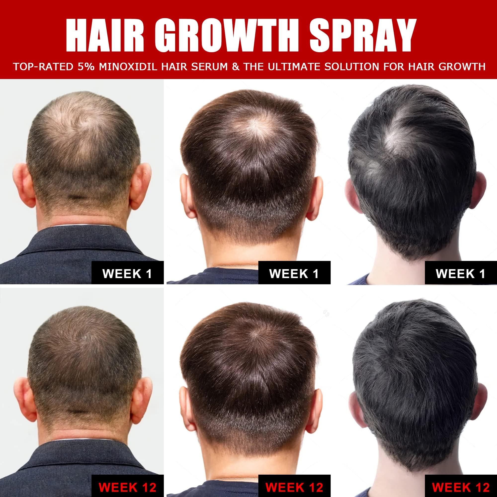 Ceessting Hair Growth Spray with Biotin, Caffeine & Niacinamide - Anti Hair Loss Treatment for Thinning Hair - Hair Regrowth Solution for Men & Women - 2oz - Perfect for Daily Use at Home, Salon or Travel
