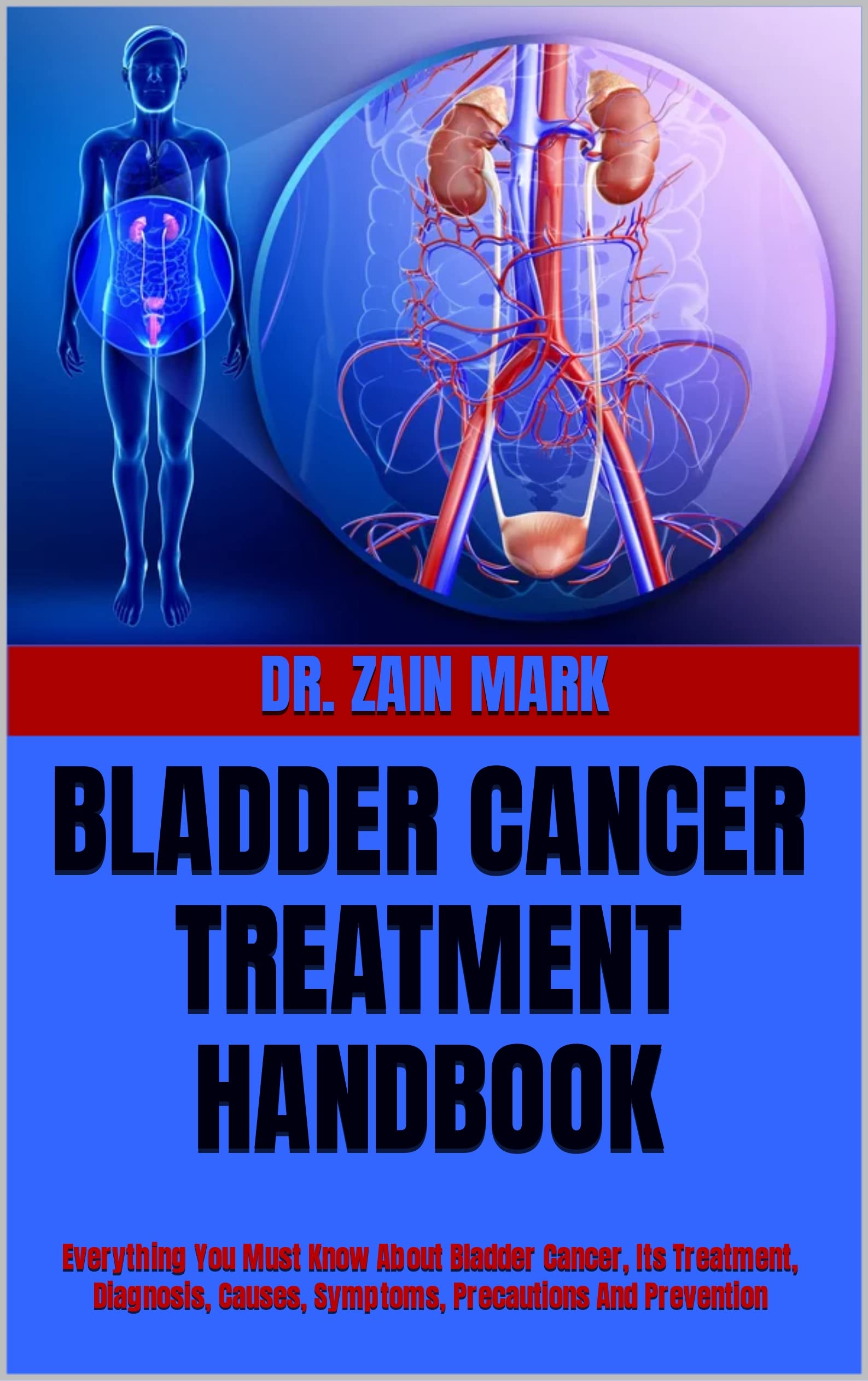 Bladder Cancer Treatment Guide: Symptoms, Diagnosis, Causes & Prevention | Comprehensive Handbook for Patients & Caregivers | Home & Clinical Use
