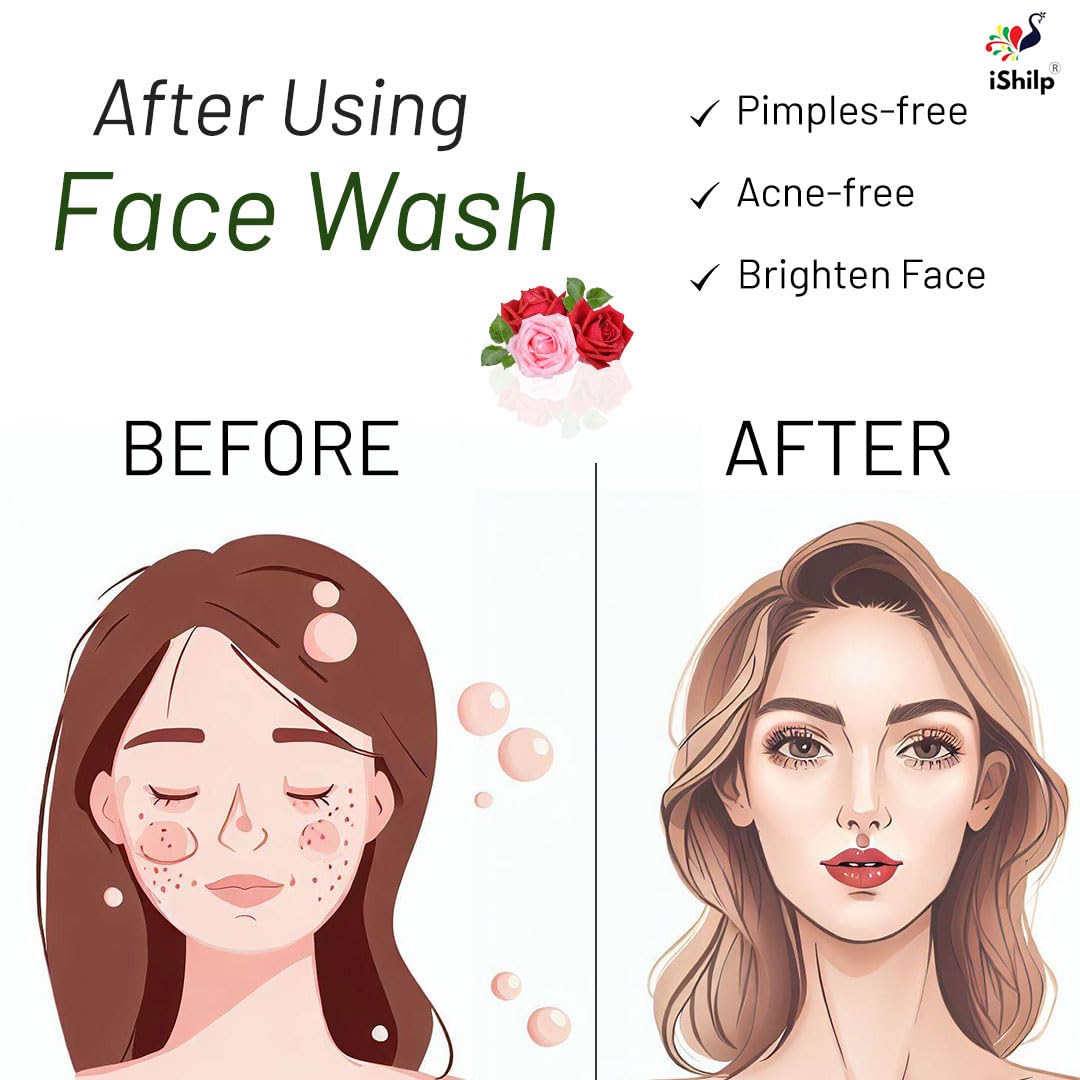 iShilp Wild Rose & Aloe Vera Face Wash for Dry Skin - Gentle Cleanser for Women & Men | 100ml | Hydrating & Soothing Daily Skincare for Sensitive Skin