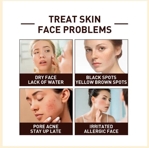 Kudh White Rice Serum for Anti-Aging & Acne - Brightening, Hydrating & Nourishing Facial Treatment (30ml) | Perfect for Daily Skincare Routine & Glowing Complexion