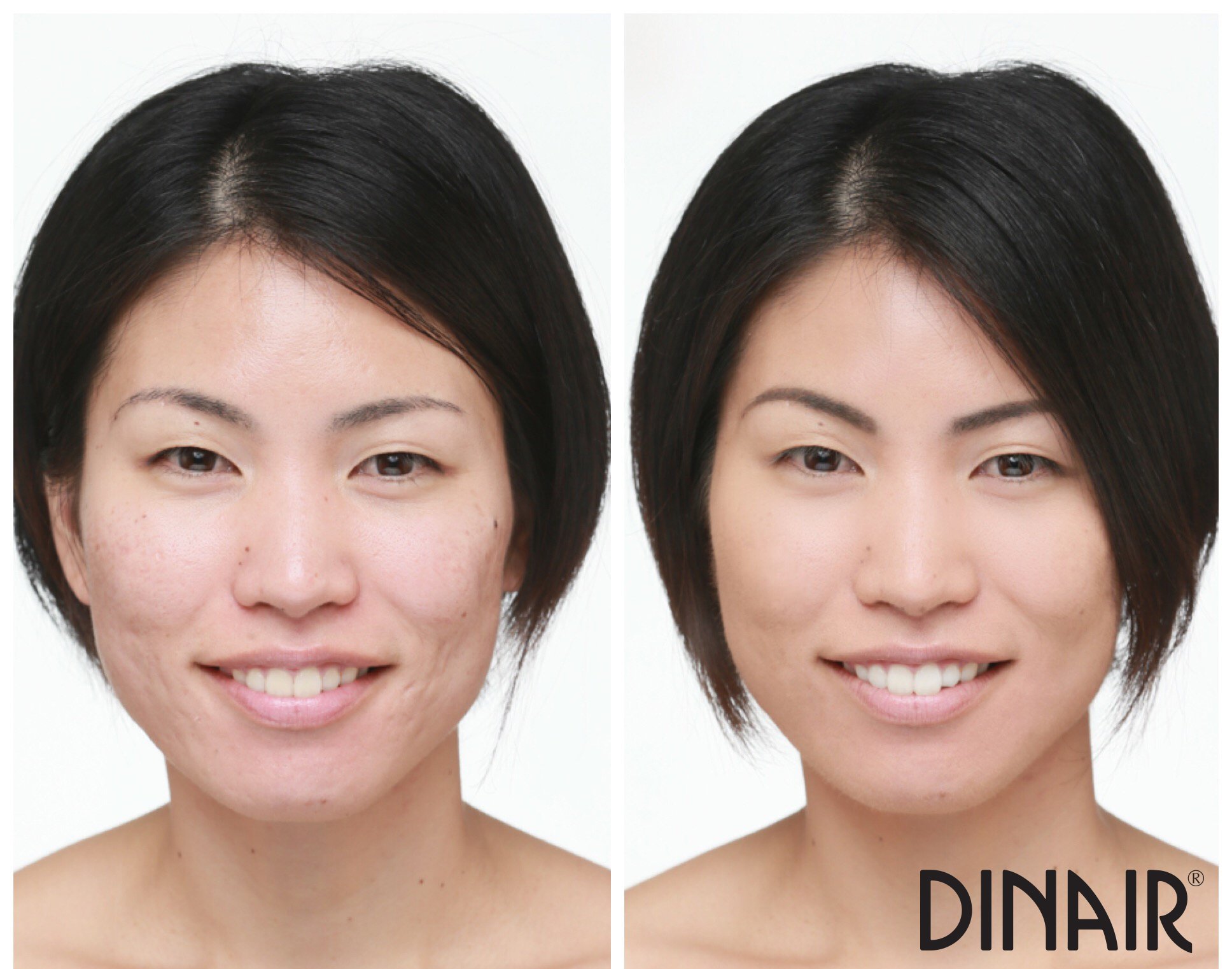 Dinair Airbrush Makeup Foundation - Alabaster 0.25 oz | Professional Camouflage Neutralizer for Scars, Acne, Tattoos, Vitiligo | Covers Under Eye Circles & Sun Spots | Perfect for Bridal, Photography & Special Occasion Makeup