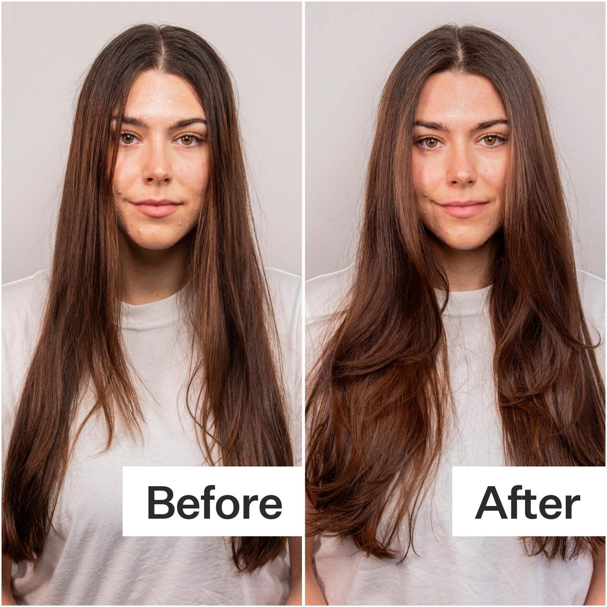 Act+Acre 4% Niacinamide Scalp Serum for Oily Hair - Oil Control & Scalp Balancing Treatment for Healthy Hair Growth - Perfect for Daily Use & Post-Workout Care