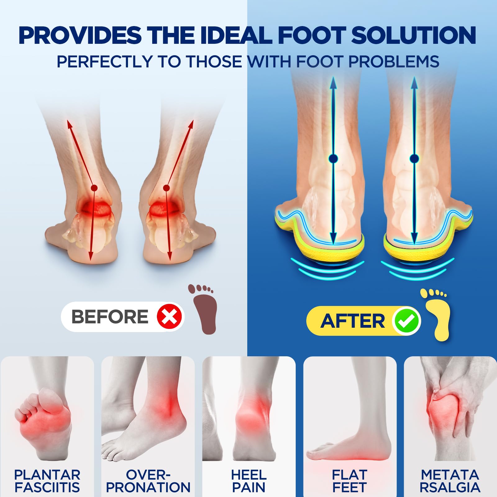 **240+lbs Plantar Fasciitis Relief Insoles for Men & Women – High Arch Support Orthotic Shoe Inserts with PORON Cushioning – Shock Absorption for Flat Feet, Pronation & Pain Relief – Ideal for Work Boots, Running & Daily Comfort**