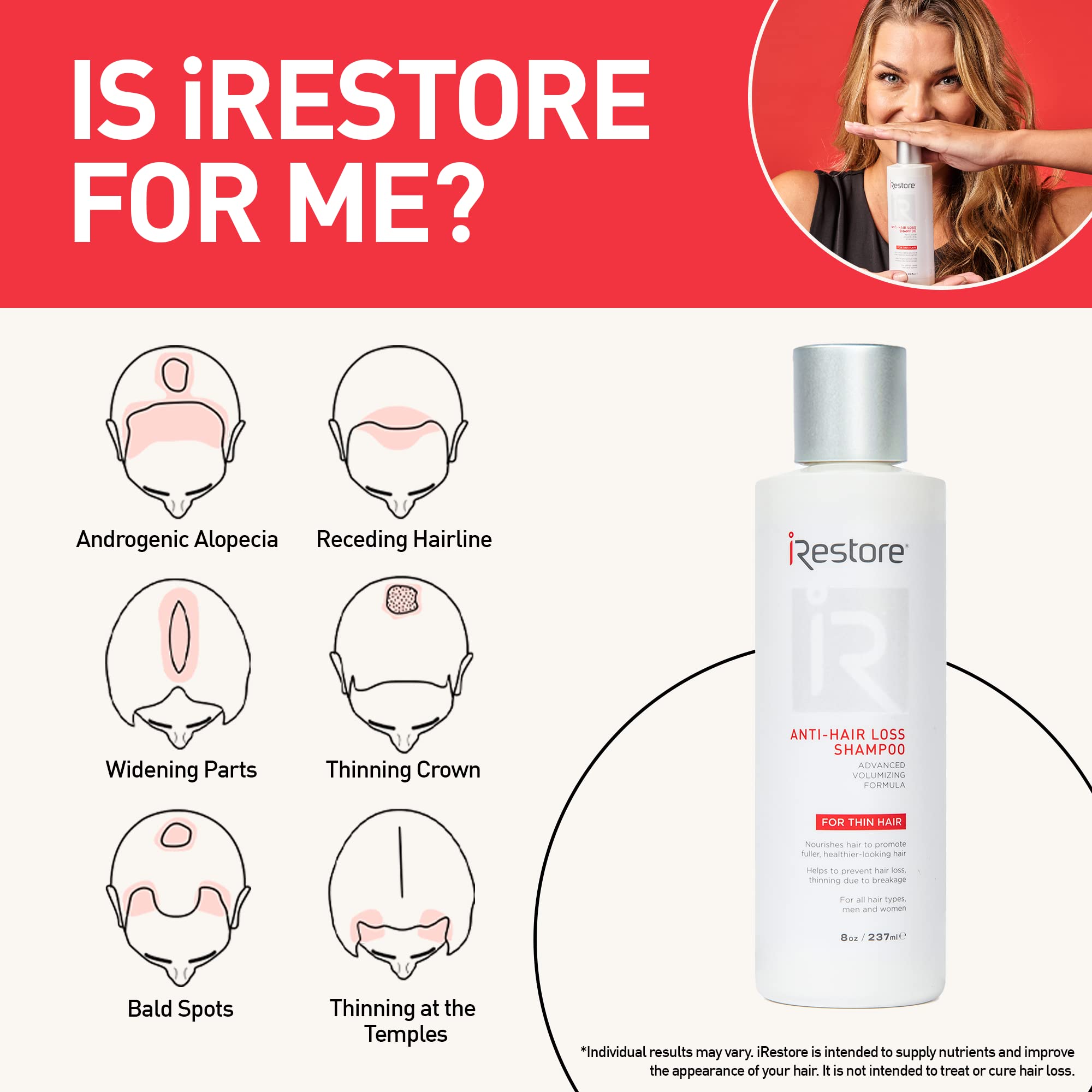 iRestore Anti Hair Loss & Thinning Shampoo with Biotin - Hair Growth Treatment for Men & Women | Volumizing & Thickening Formula for Fuller Hair | Daily Use for Healthy Scalp & Stronger Strands