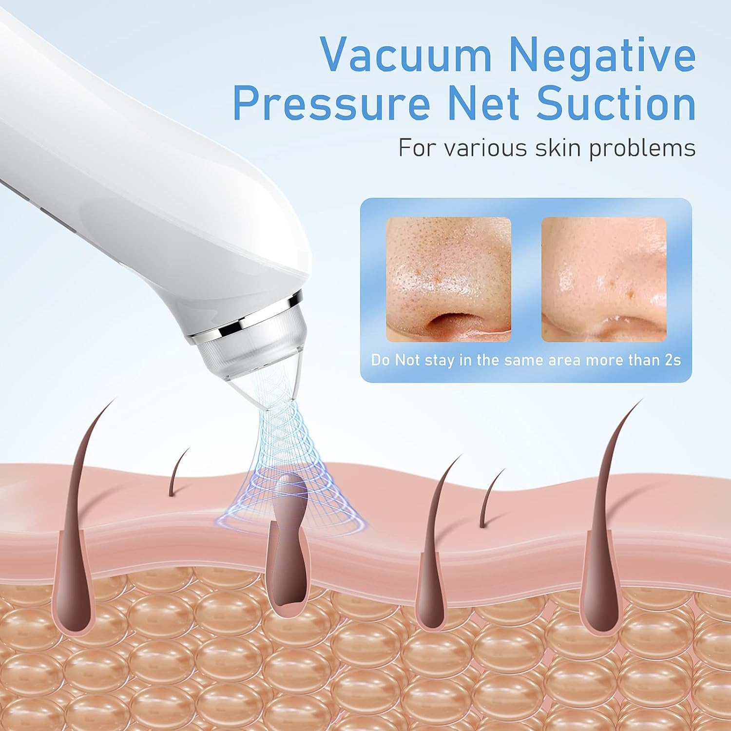 USB Blackhead Remover Vacuum with Camera - 3 Modes & 6 Heads for Deep Pore Cleaning at Home (Light Pink)