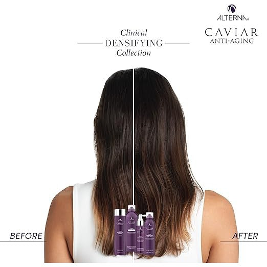 Alterna Caviar Anti-Aging Densifying Foam Conditioner for Thinning Hair - Volumizing & Hydrating Treatment - 8.5 oz - Perfect for Fine, Flat Hair & Scalp Care
