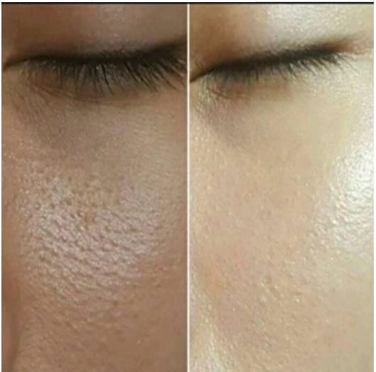 Vinban BB Glow Permanent Treatment Kit - 12 Serum Set for Professional Skin Brightening & Anti-Aging | At-Home Facial Treatment & Salon-Quality Glow