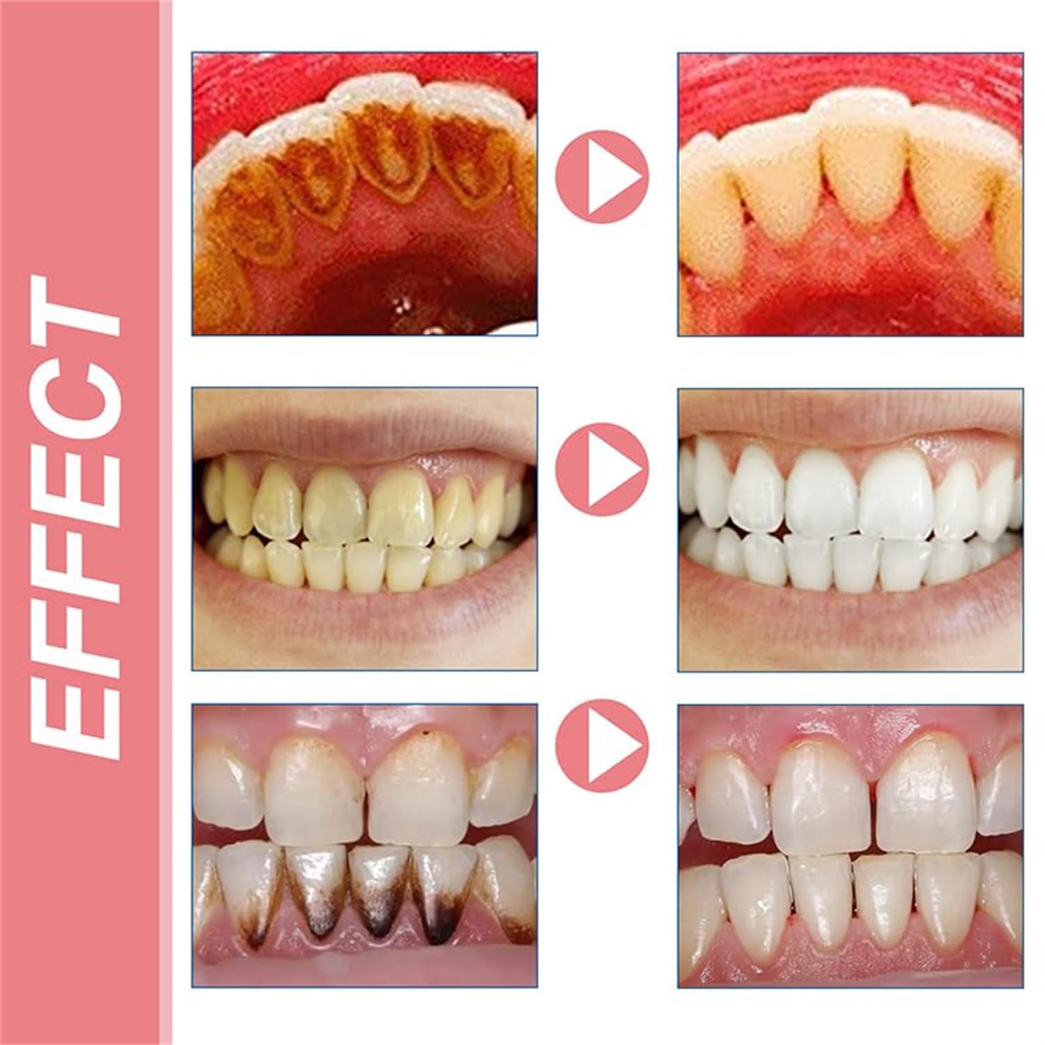 SP8 Probiotics Toothpaste for Teeth Whitening & Deep Cleaning - Ultra Brightening & Fresh Breath Oral Care - Ideal for Daily Use, Travel & Sensitive Teeth