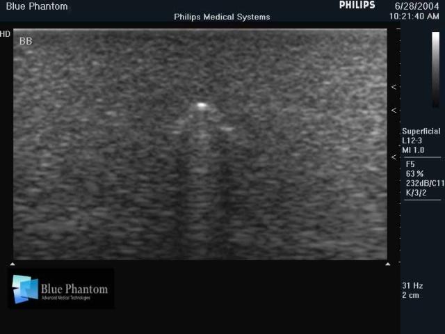 Foreign Body Identification Ultrasound Training Model - High-Quality Medical Simulation Tool for Emergency & Trauma Practice - Perfect for Medical Students, Nurses & First Responders