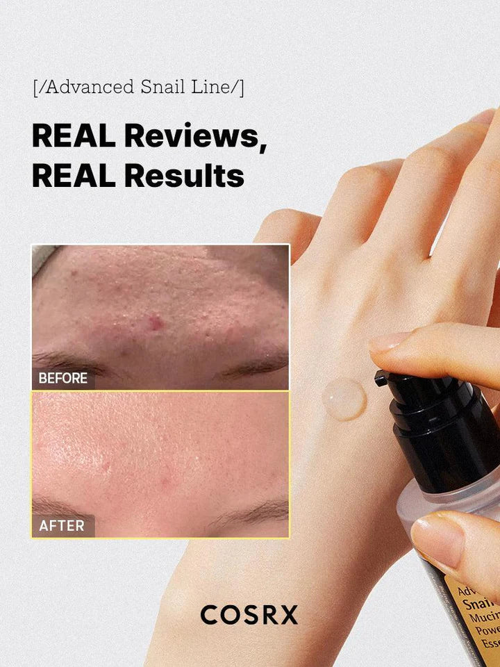 COSRX Advanced Snail 96 Mucin Power Essence 100ml - Korean Skincare for Hydration & Anti-Aging - Perfect for Dry Skin & Nighttime Routine