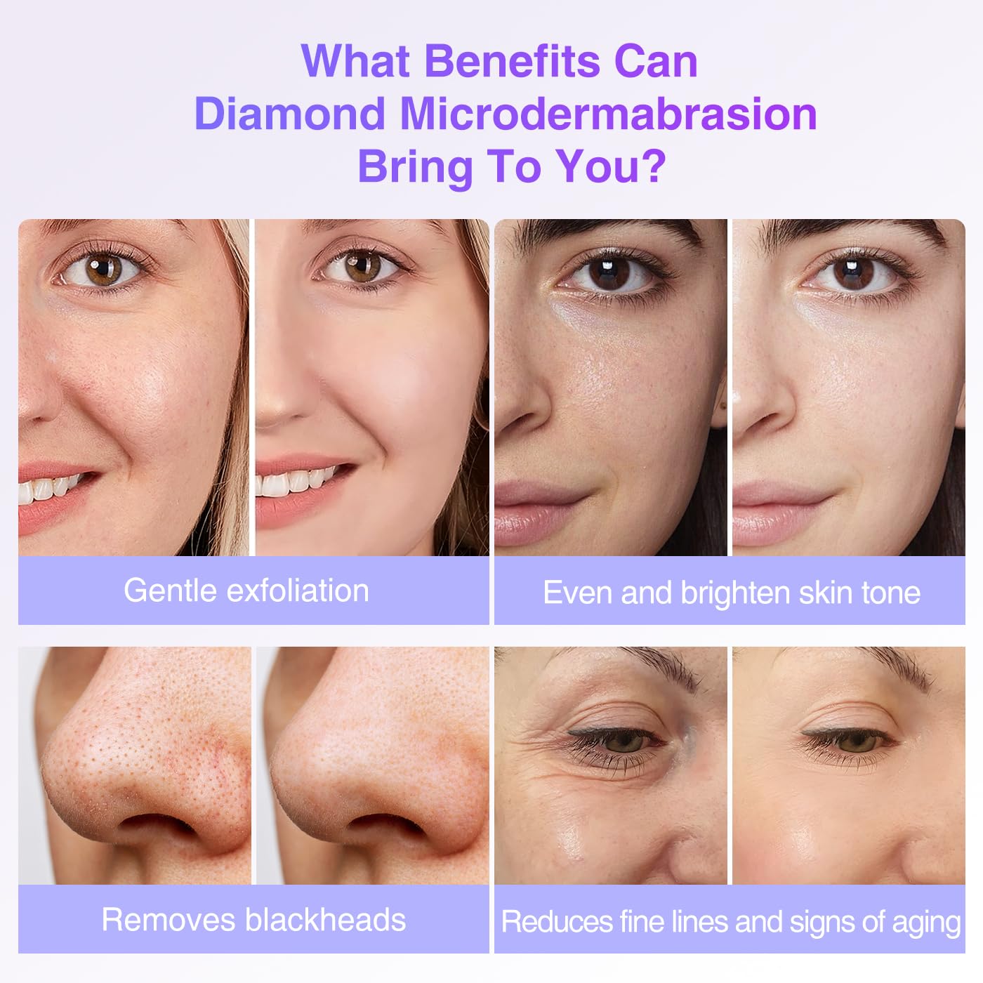 Professional Diamond Microdermabrasion Machine with 6 Diamond Heads - At-Home Facial Exfoliation for Glowing Skin | Perfect for Acne Treatment, Anti-Aging & Skin Rejuvenation
