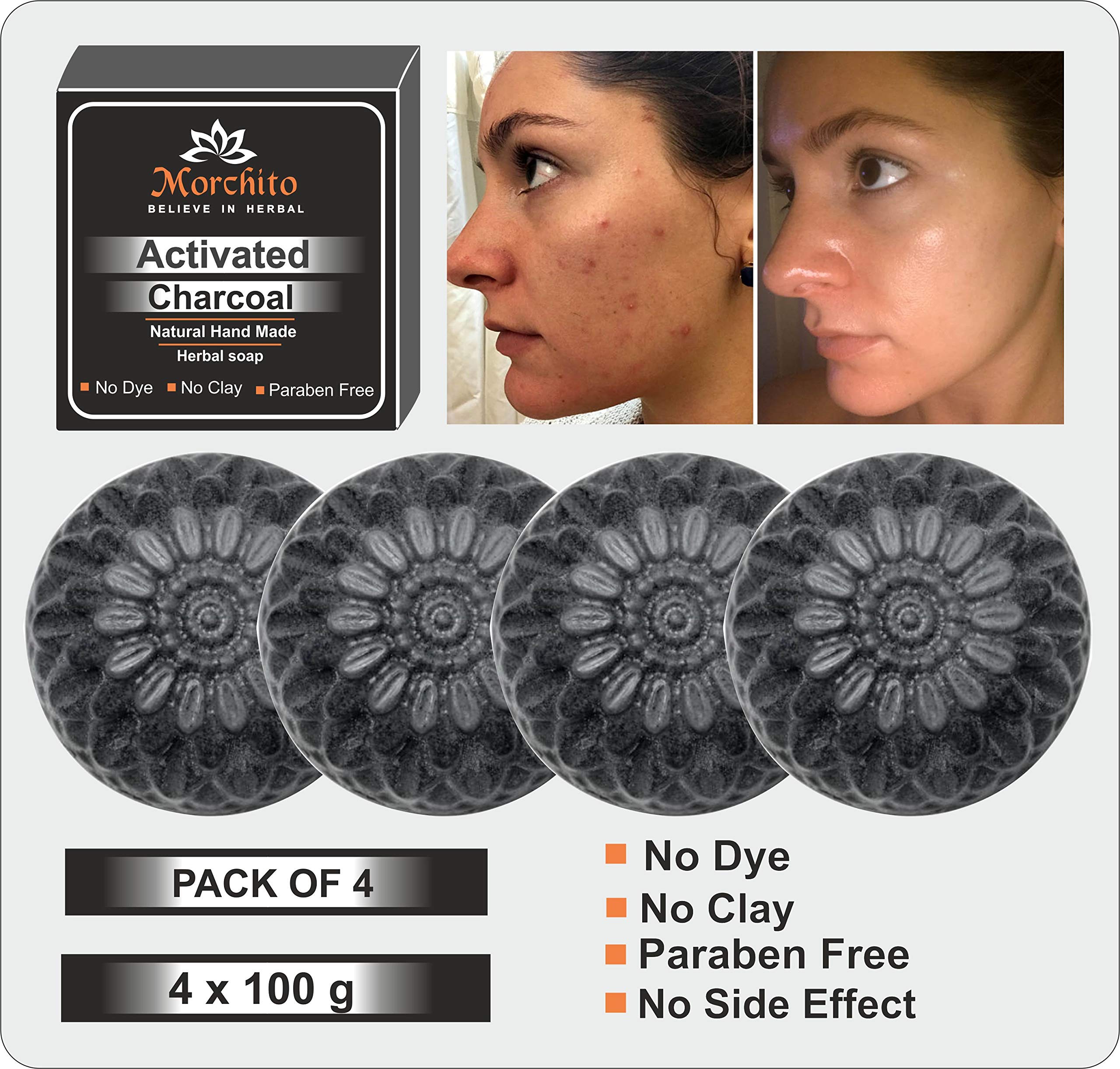 Mahalaxmi Activated Charcoal Soap for Women - Skin Whitening, Acne & Blackhead Treatment, Anti-Wrinkle Care (4-Pack, 4x100g) | Perfect for Daily Cleansing & Deep Pore Detox