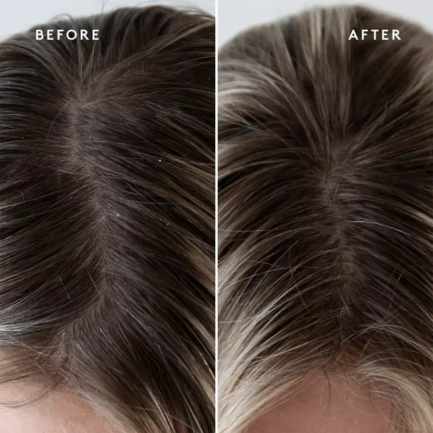 Virtue Exfoliating Scalp Treatment - Gentle Exfoliator for Healthy Hair & Scalp - Perfect for Dry, Itchy Scalp & Dandruff Relief