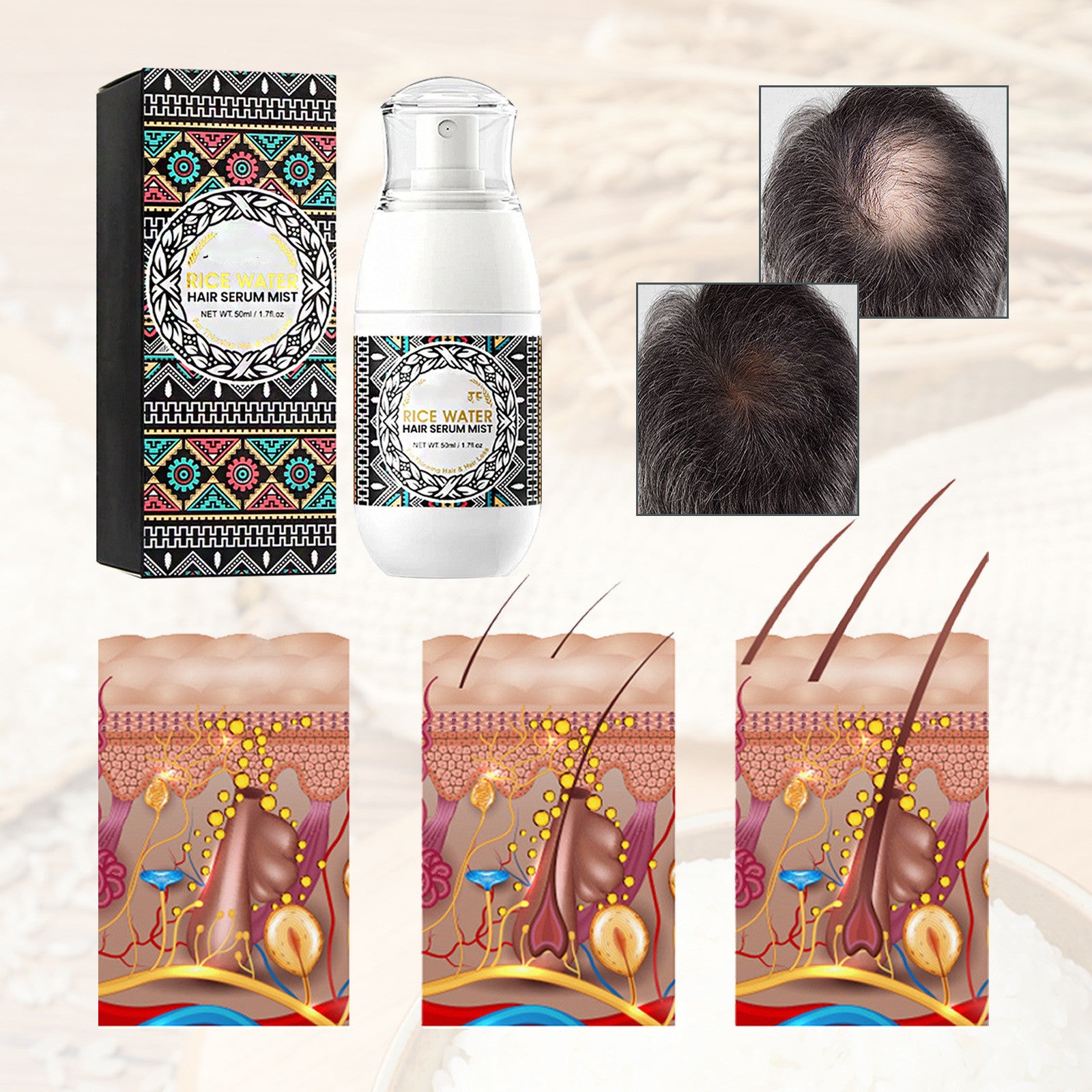 Rice Water Hair Growth Spray - Hydrating Scalp Treatment for Dry & Damaged Hair - Perfect for Daily Use & Hair Care Routine