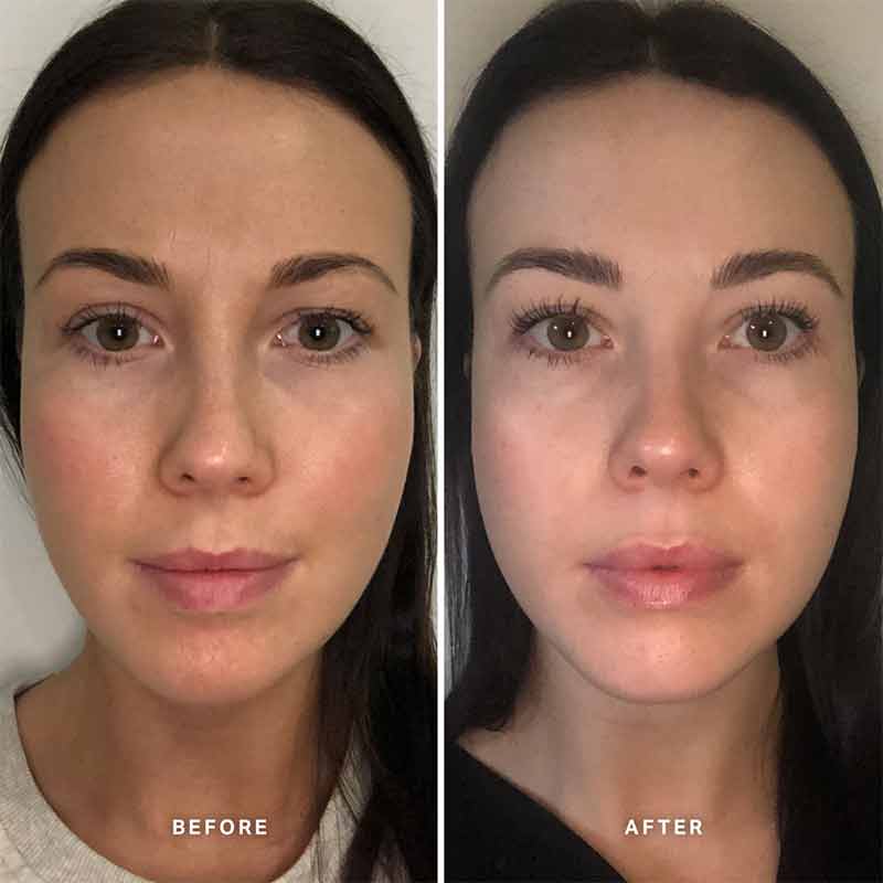 Alpha H Vitamin B Serum with 5% Niacinamide - Brightening & Hydrating Face Serum for Glowing Skin - Perfect for Daily Skincare Routine & Anti-Aging Care