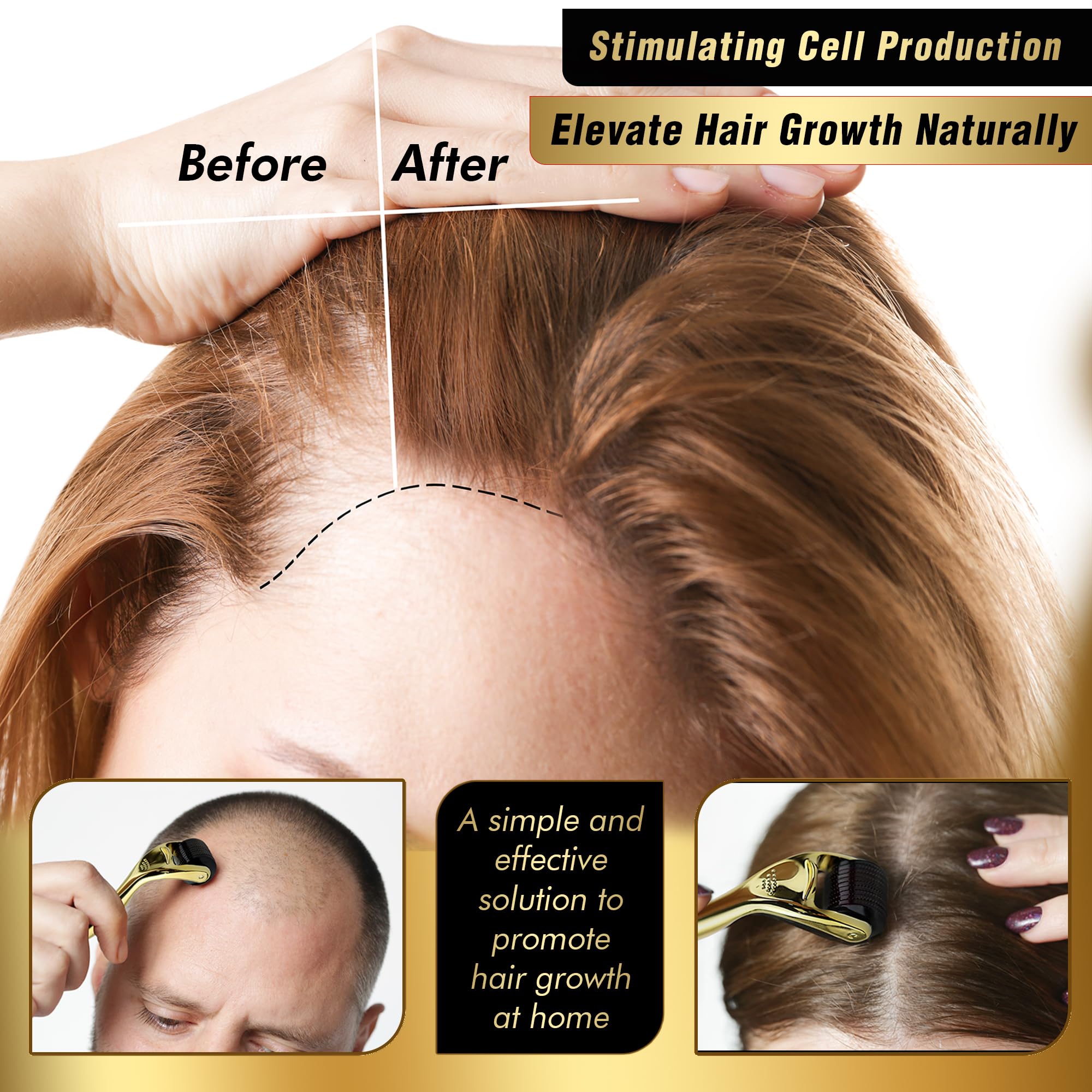 Professional 0.25mm Titanium Derma Roller for Face, Beard & Hair Growth - Microneedling Skin Care Tool for Men & Women - Perfect for Anti-Aging, Wrinkles & Hair Regrowth at Home