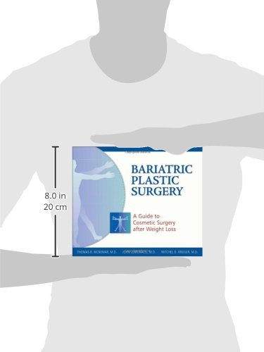 Bariatric Plastic Surgery Guide: Post-Weight Loss Cosmetic Procedures for Body Contouring & Skin Tightening | Ideal for Weight Loss Patients & Post-Bariatric Surgery Recovery