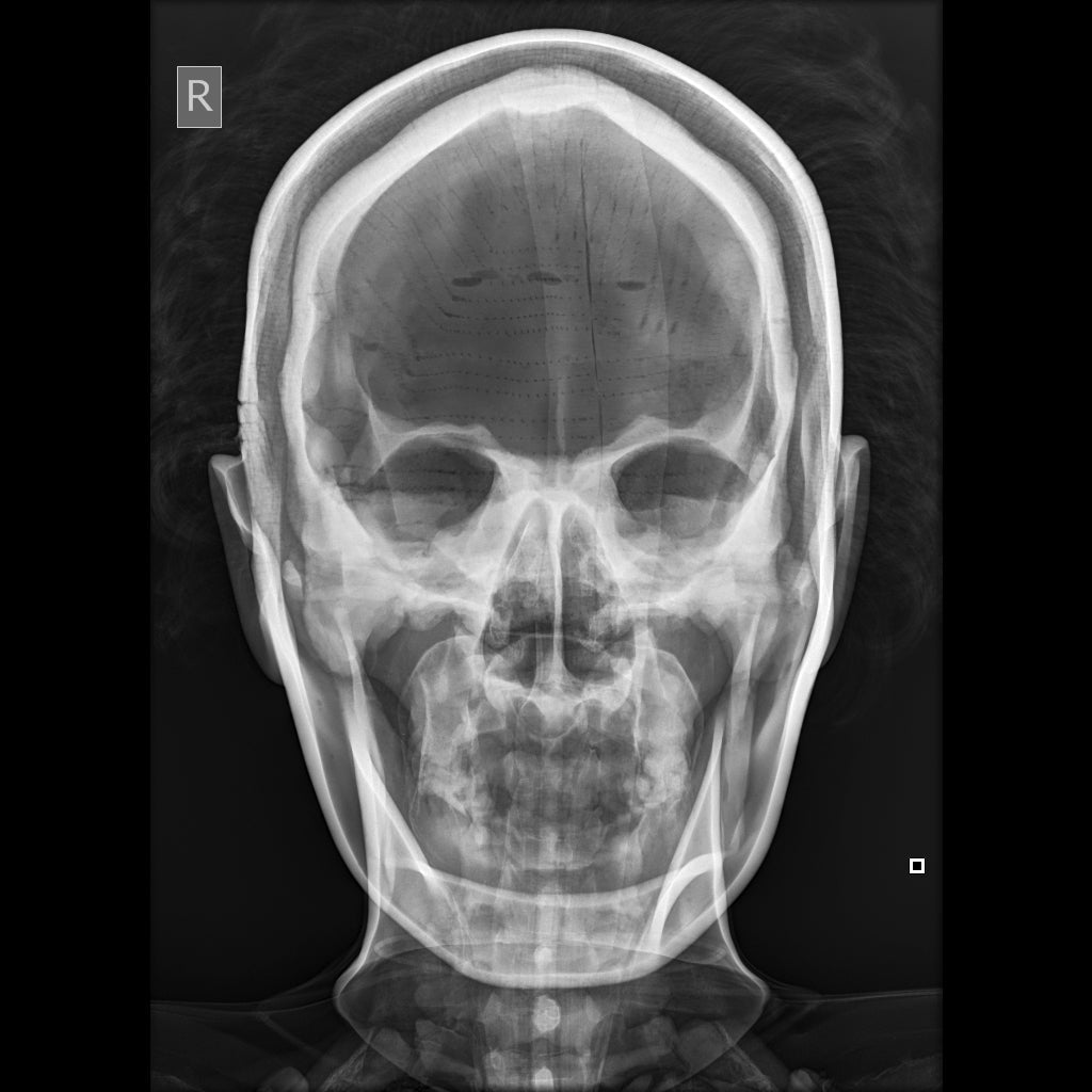 Full Body X-Ray and Radiographic Positioning Manikin - Professional Medical Training Model for Radiology Students & Technicians - Perfect for Classroom, Lab & Clinical Practice