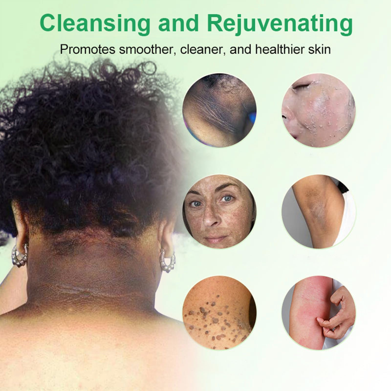 Lenaro JORONDY Purifying Exfoliating Gel - Gentle Face Scrub for Men & Women, Deep Cleansing Peel & Dead Skin Remover - Perfect for Daily Skincare Routine & Blackhead Treatment