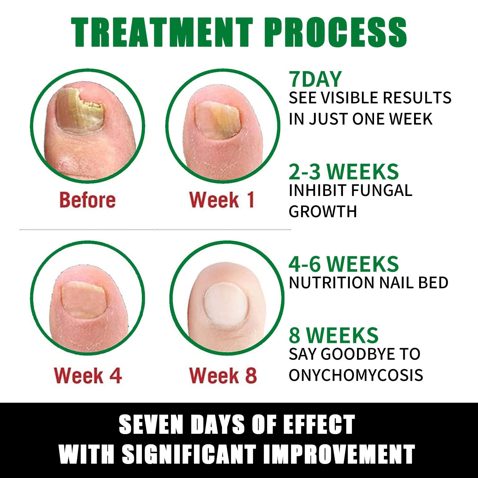 7 Days Nail Fungus Treatment - Ginger & Turmeric Nail Repair Serum for Damaged, Brittle & Peeling Nails | Fast Absorbing, Non-Greasy Cuticle Oil | Hydrating Nail Care Solution for Fungal Infections & Healthy Nails | Perfect for Daily Use at Home or Salon
