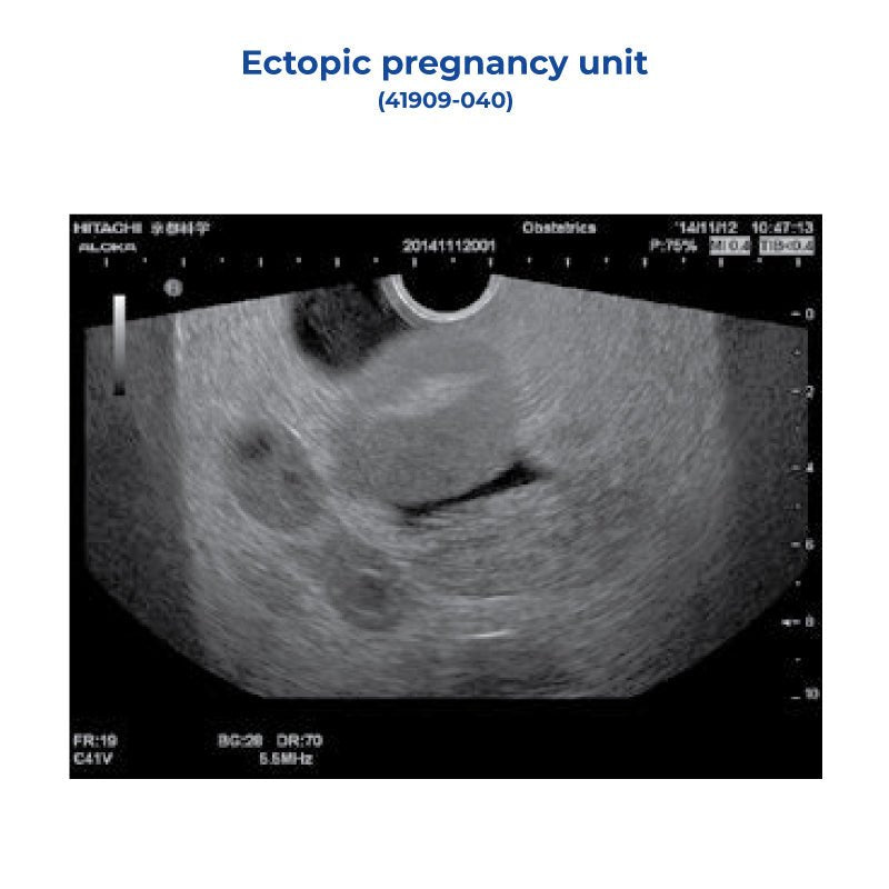 Early Pregnancy Test Kit for Ectopic Pregnancy Detection - Accurate Home HCG Urine Test Strips for Women | Fertility Tracking, Emergency Pregnancy Monitoring & OBGYN Recommended