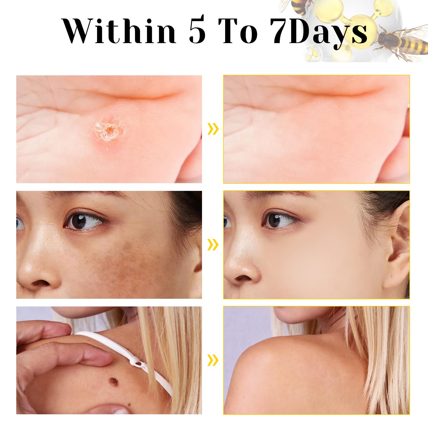 2025 New Bee Venom Treatment Cream - Professional Natural Repair Gel for All Skin Types (2 Bottles) | Soothes Dryness, Redness & Skin Irritation | Perfect for Daily Skincare & Post-Treatment Care