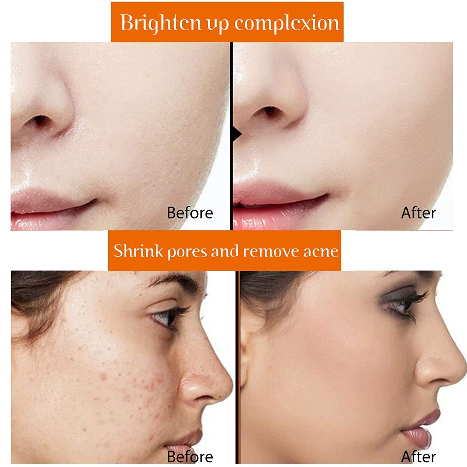 Quat 20% Vitamin C Face Serum for Glowing Skin - Brightening & Anti-Aging Facial Treatment with Hyaluronic Acid | Day & Night Use for Women