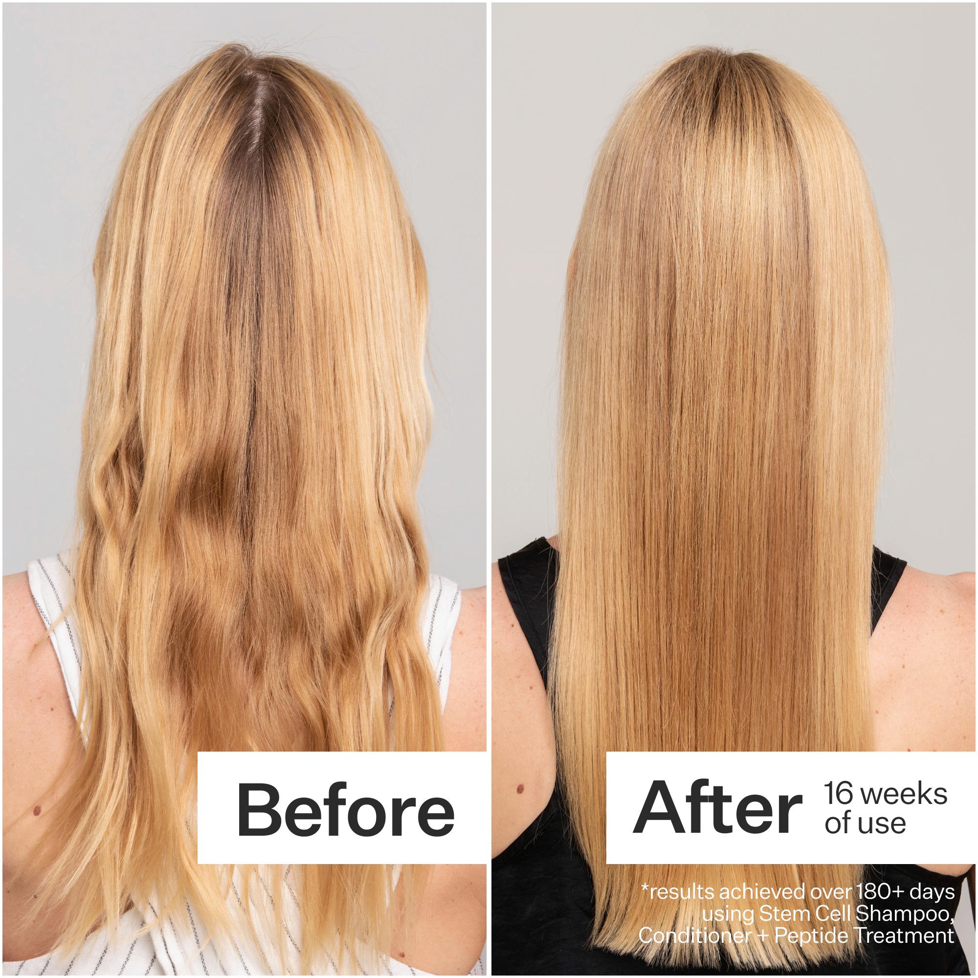Act+Acre Stem Cell Hair Conditioner for Damaged Hair - Repair & Hydrate Dry, Frizzy Hair - Perfect for Daily Use & Post-Color Treatment