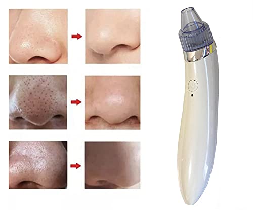 USB Rechargeable Blackhead Remover & Pore Cleaner - 3 Speed Facial Suction Tool for Deep Cleansing - Perfect for Acne Prone Skin & Blackhead Removal at Home