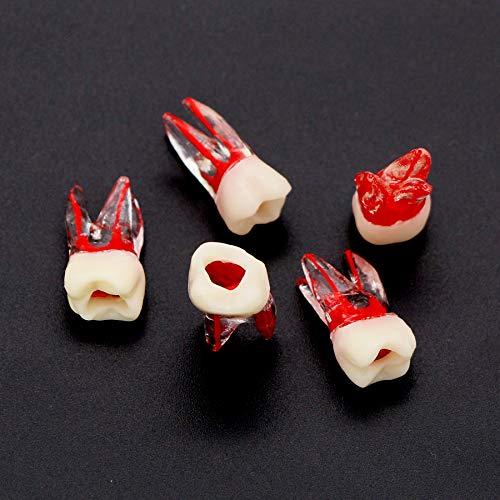 5 Pcs Dental Teeth Model for RCT Practice - M8008-36# - Perfect for Dental Students, Dentist Training & Orthodontic Education