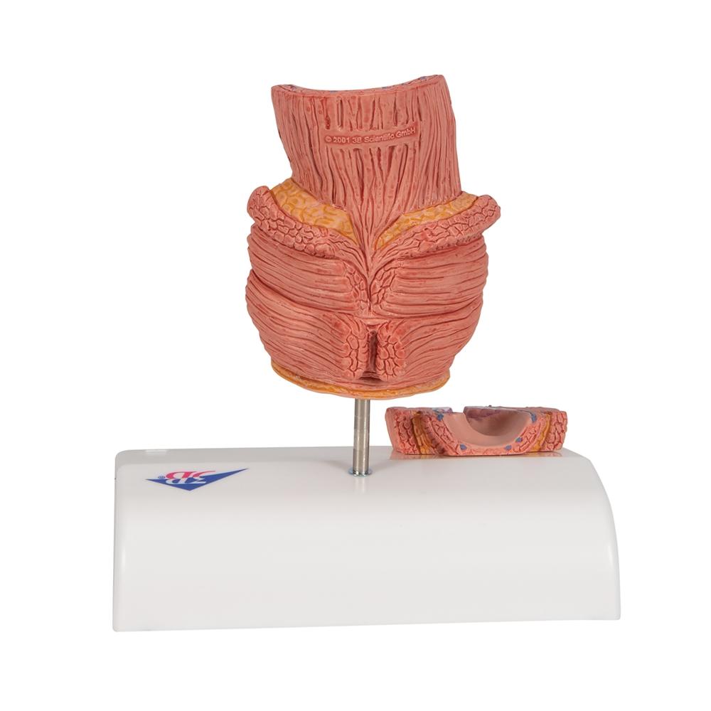 Premium Hemorrhoid Anatomy Model for Medical Training & Patient Education – Ideal for Doctors, Nurses & Healthcare Professionals